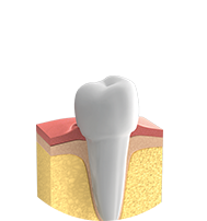 Parodontologie - Gesundes Zahnfleisch